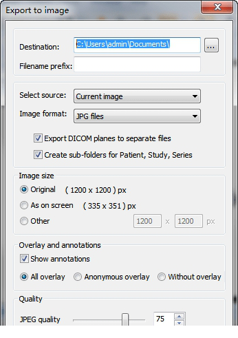 MicroDicom viewer免费版