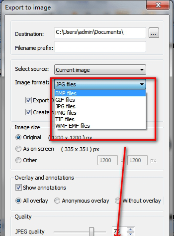 MicroDicom viewer免费版