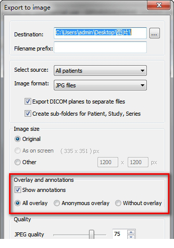 MicroDicom viewer免费版