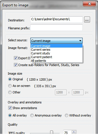 MicroDicom viewer免费版