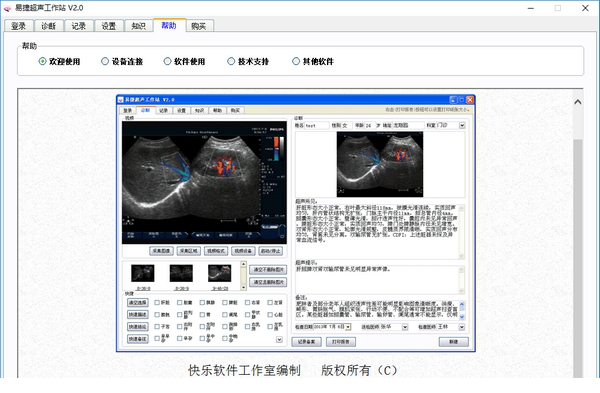易捷超声工作站