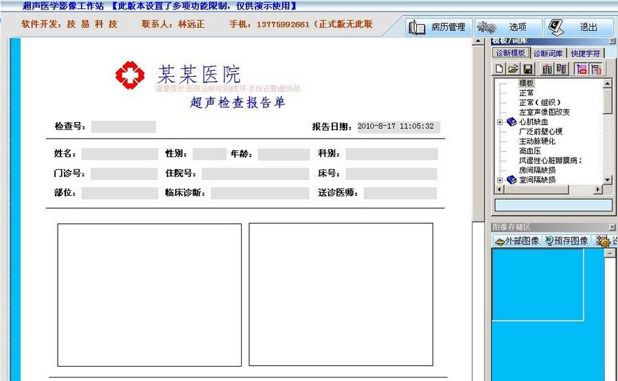 超声工作站软件 2018