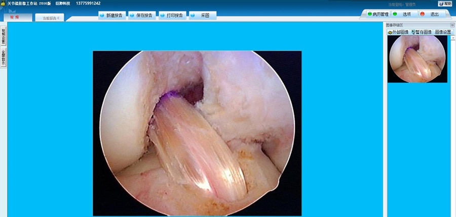 巨渺关节镜图文工作站 v20112