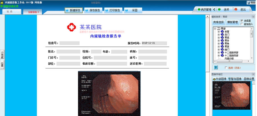 巨渺医学影像工作站查询系统 v2017 缂冩垹绮秜1.4