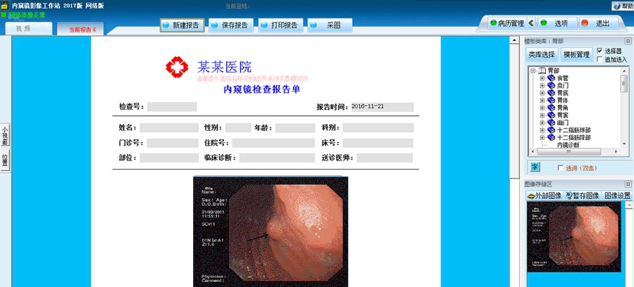巨渺医学报告浏览器 v20113