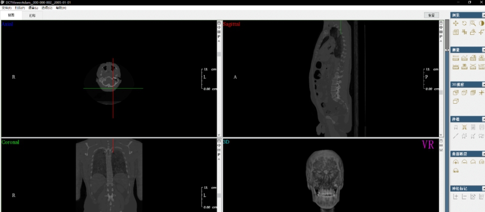 DCTViewer (CBCT查看器) v2.0.8