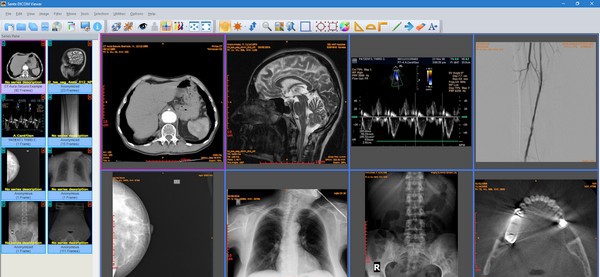 Sante DICOM Viewer(医疗办公软件) v11.8.13