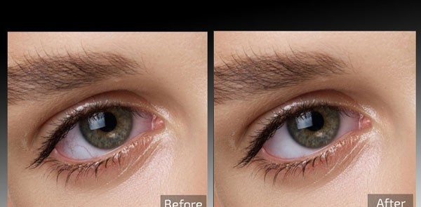 Retouch4me Eye Vessels(图片处理工具) v0.9.9.9